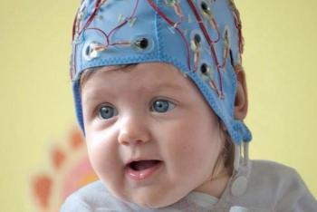 Vaikų smegenų encefalograma