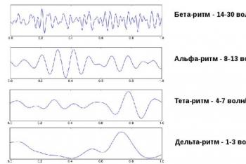 EEG tiriant smegenis – ką tai rodo?